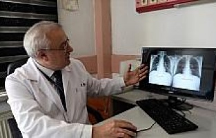 Ölümcül akciğer hastalığından sadece sigarayı bırakarak kurtuldu